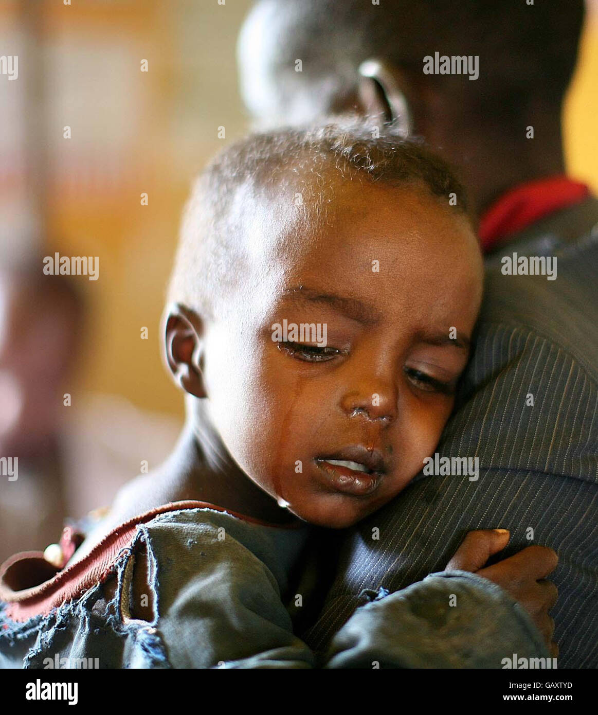 A young malnourished child waits on his father's shoulder in Edo Health Clinic, Southern Ethiopia. Tens of thousands of Ethiopians are on the brink of starving to death as a result of a massive food shortage. Some 3,200 children and women have been admitted to food treatment programmes in just one southern region in recent weeks as the effects of an eight-month drought take hold of rural communities. Stock Photo