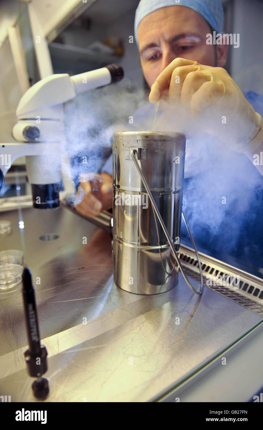 Lyndon Miles, Head of Embryology and Andrology for IVF Wales at the University Hospital of Wales in Cardiff dips an embryo, which is on a CryoLeaf into a flask of liquid nitrogen to instantly freeze it as part of the new vitrification process, which works by rapid freezing rather than slow freezing. Stock Photo