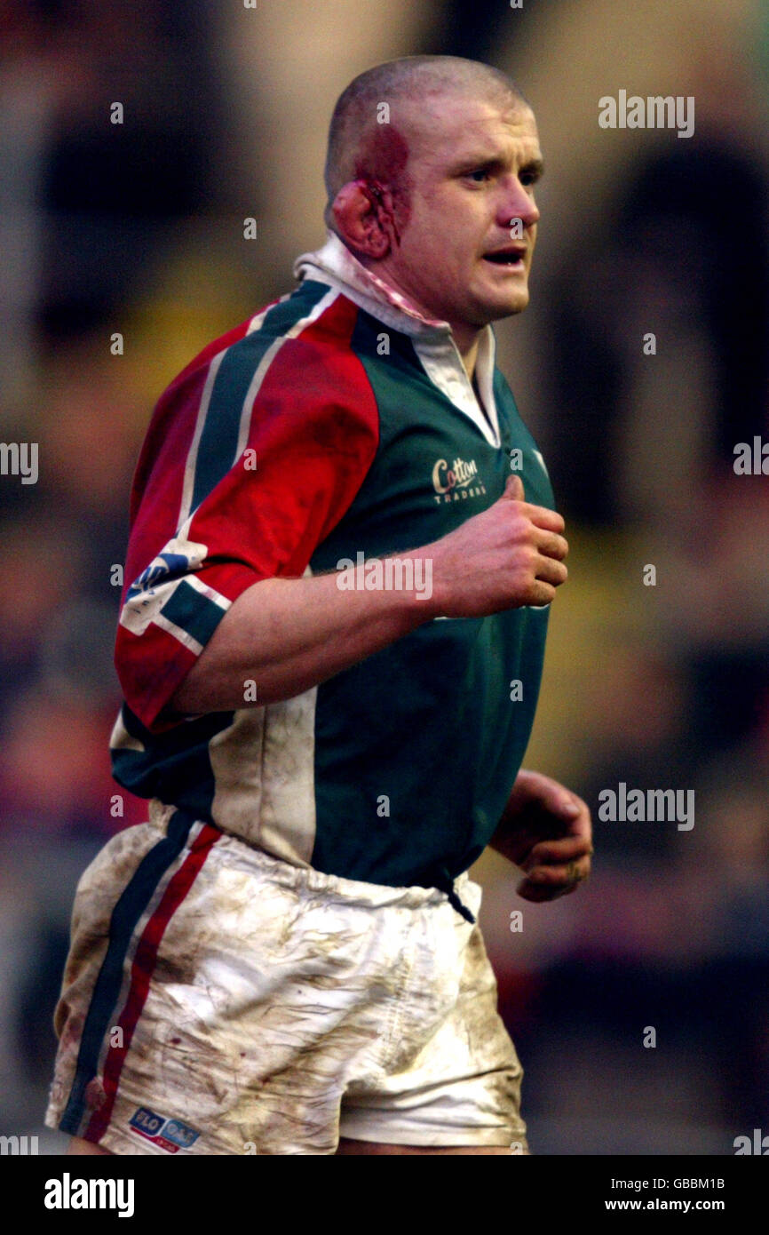 Cauliflower Ear Burst