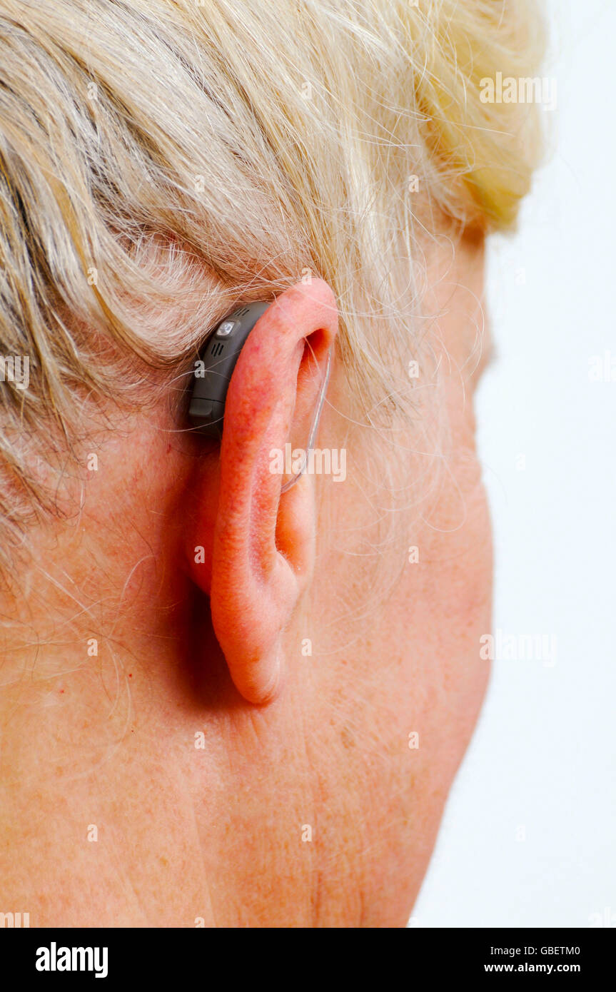 Modern small hearing aid, woman, 55 60 years, hardness of hearing