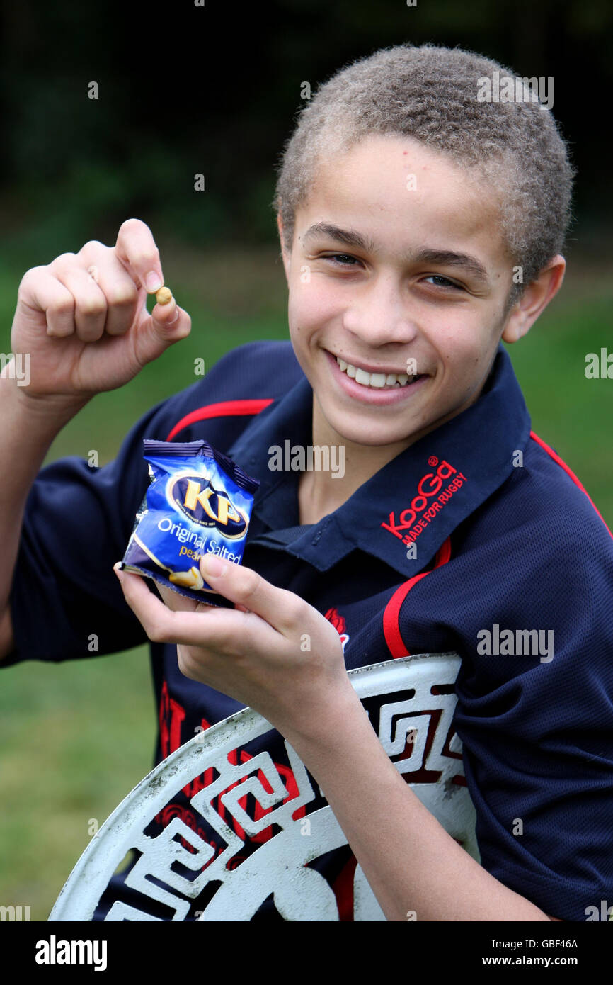Carl Morris, 13, from Impington, Cambridgeshire, smiles as he holds a peanut, after successfully taking part in a medical trial that has cured him of his nut allergy. Stock Photo