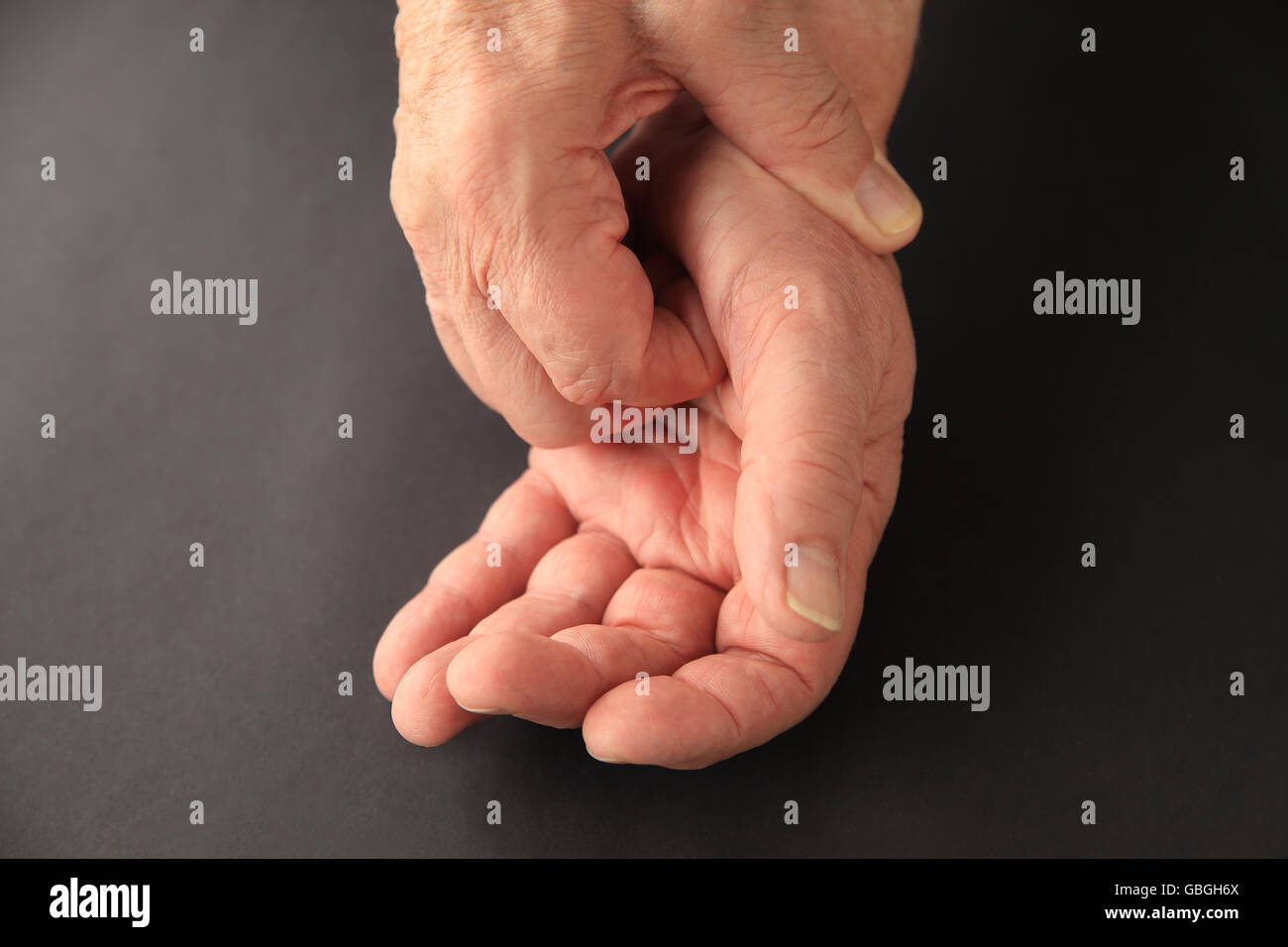 Senior man scratches an irritated area on his palm. Stock Photo