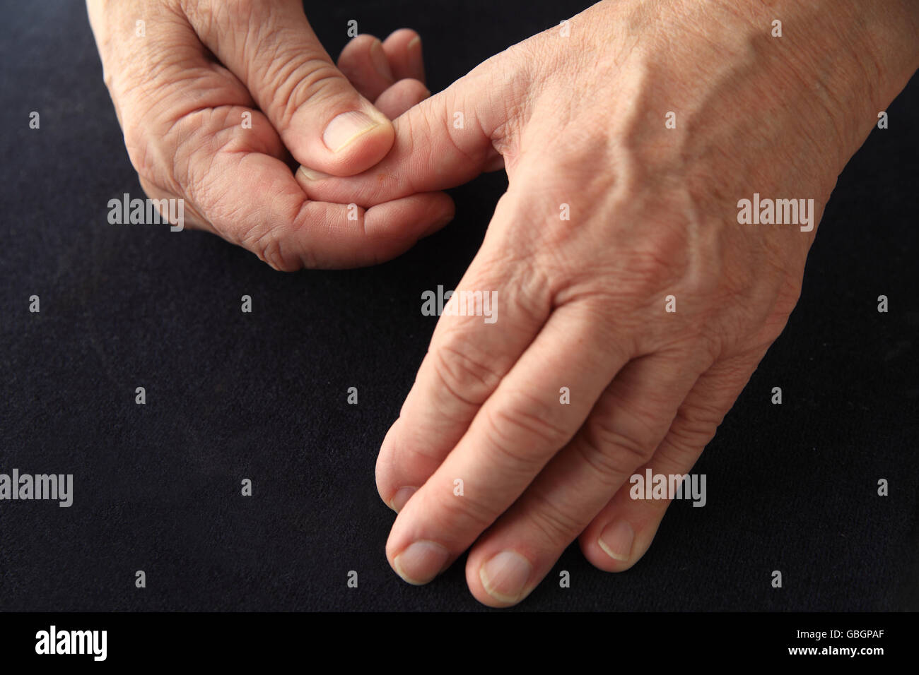 Older man has an aching thumb. Stock Photo