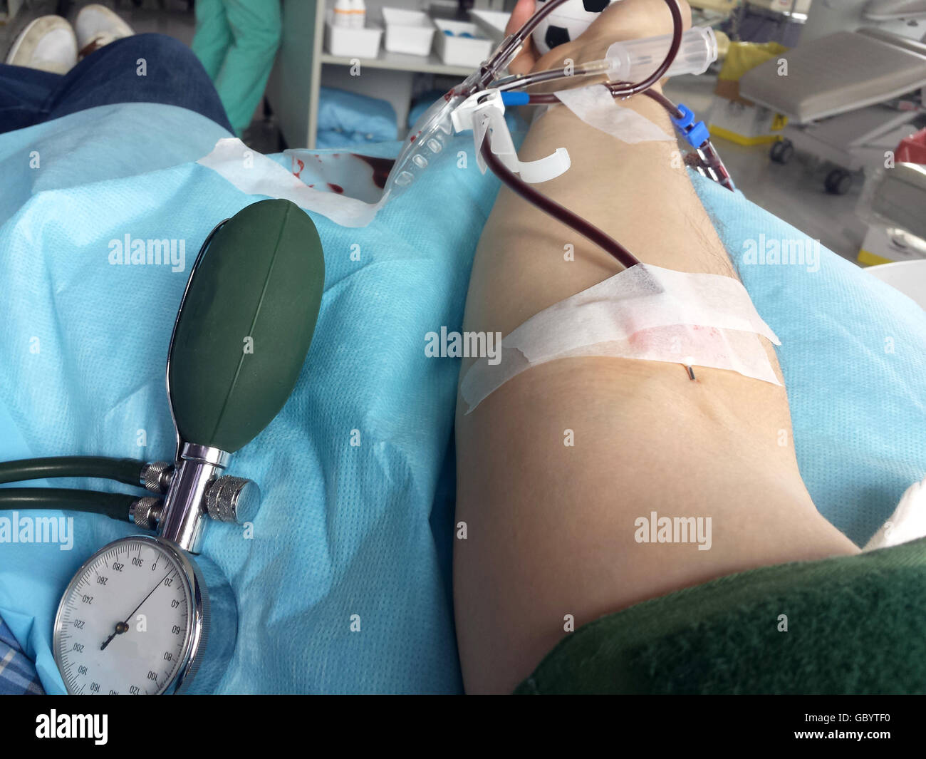 arm of the young volunteer when donating blood in hospital bed 3 Stock Photo