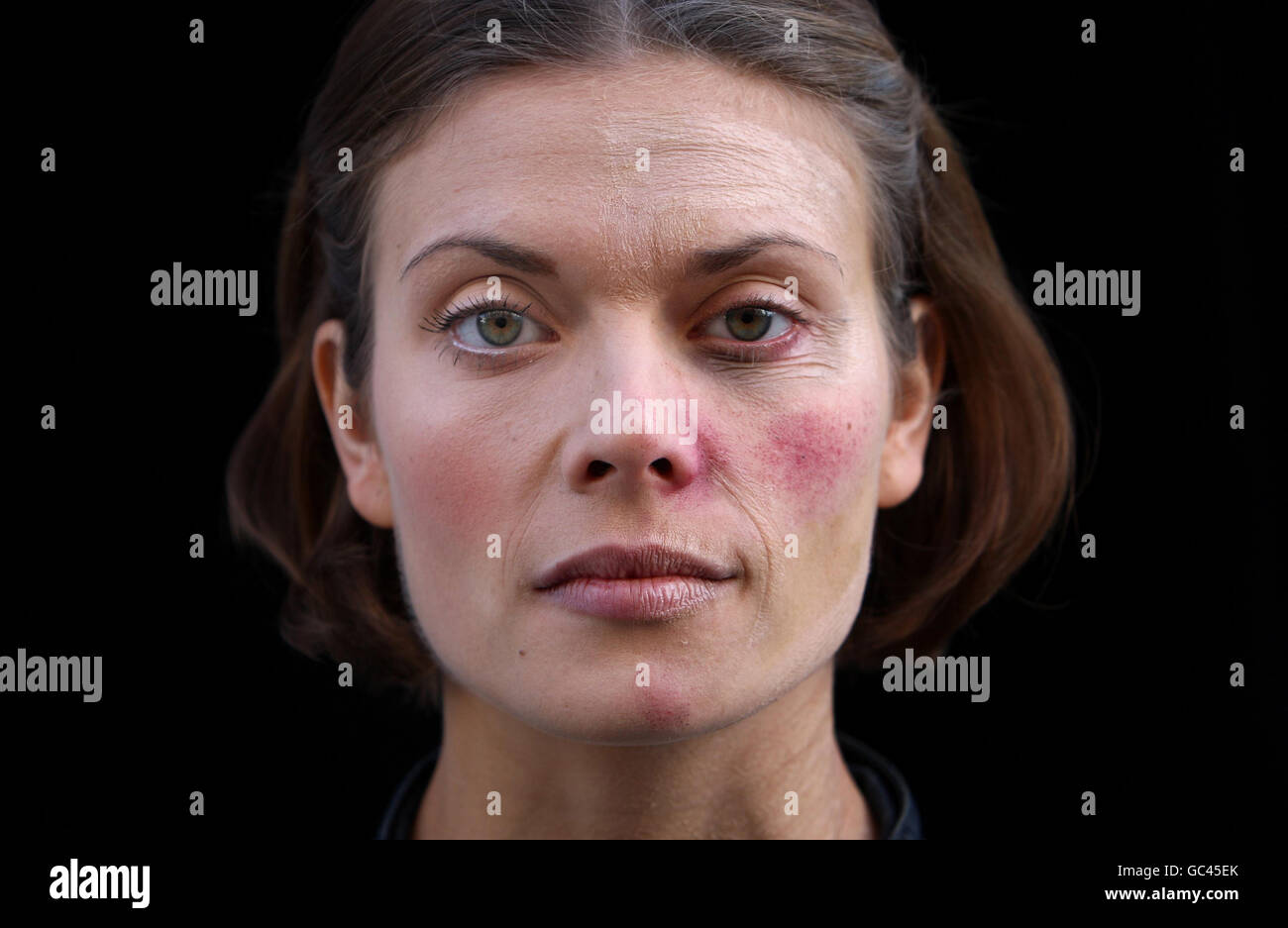 Model Julia Bisby poses to demonstrate the effects of excessive alcohol consumption on her appearance. Stock Photo