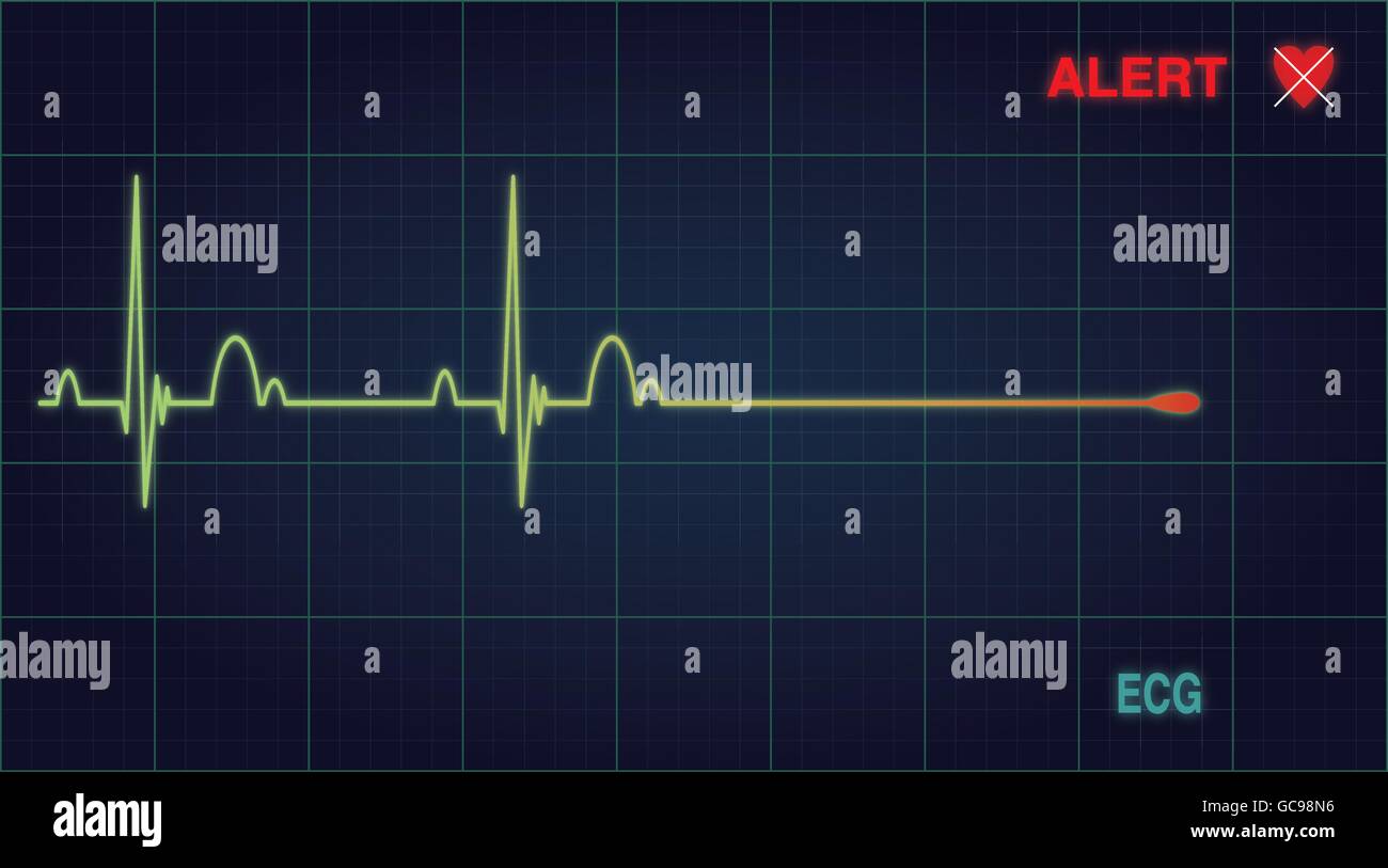 Flat line alert on a heart monitor. Vector illustration Eps 10 Stock Vector
