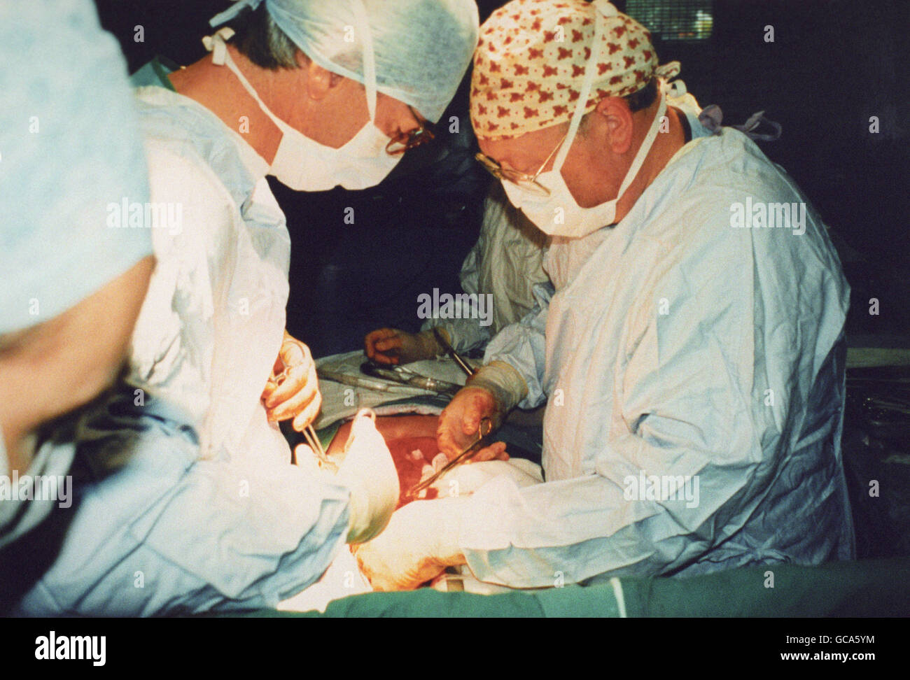 SURGICAL TEAM MEMBERS IMPLANT A A NEW HEART ASSIST DEVICE, KNOWN AS A LEFT VENTRICULAR ASSIST DEVICE [LVAD], DURING A FOUR HOUR OPERATION AT PAPWORTH HOSPITAL IN CAMBRIDGESHIRE. Stock Photo