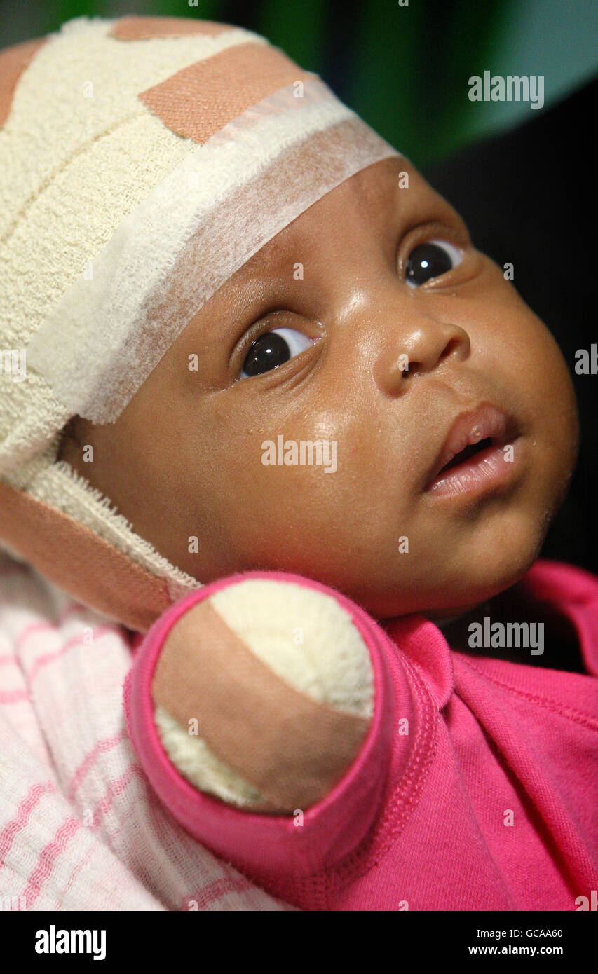 Haiti hospital care hi-res stock photography and images - Alamy