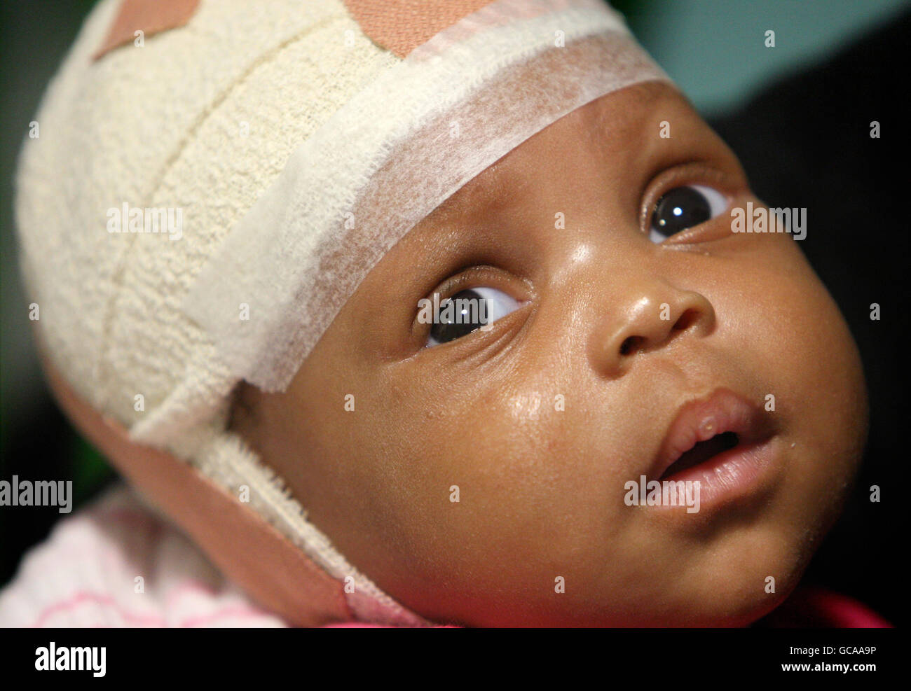 Hospital injuries child bandage hi-res stock photography and images - Alamy