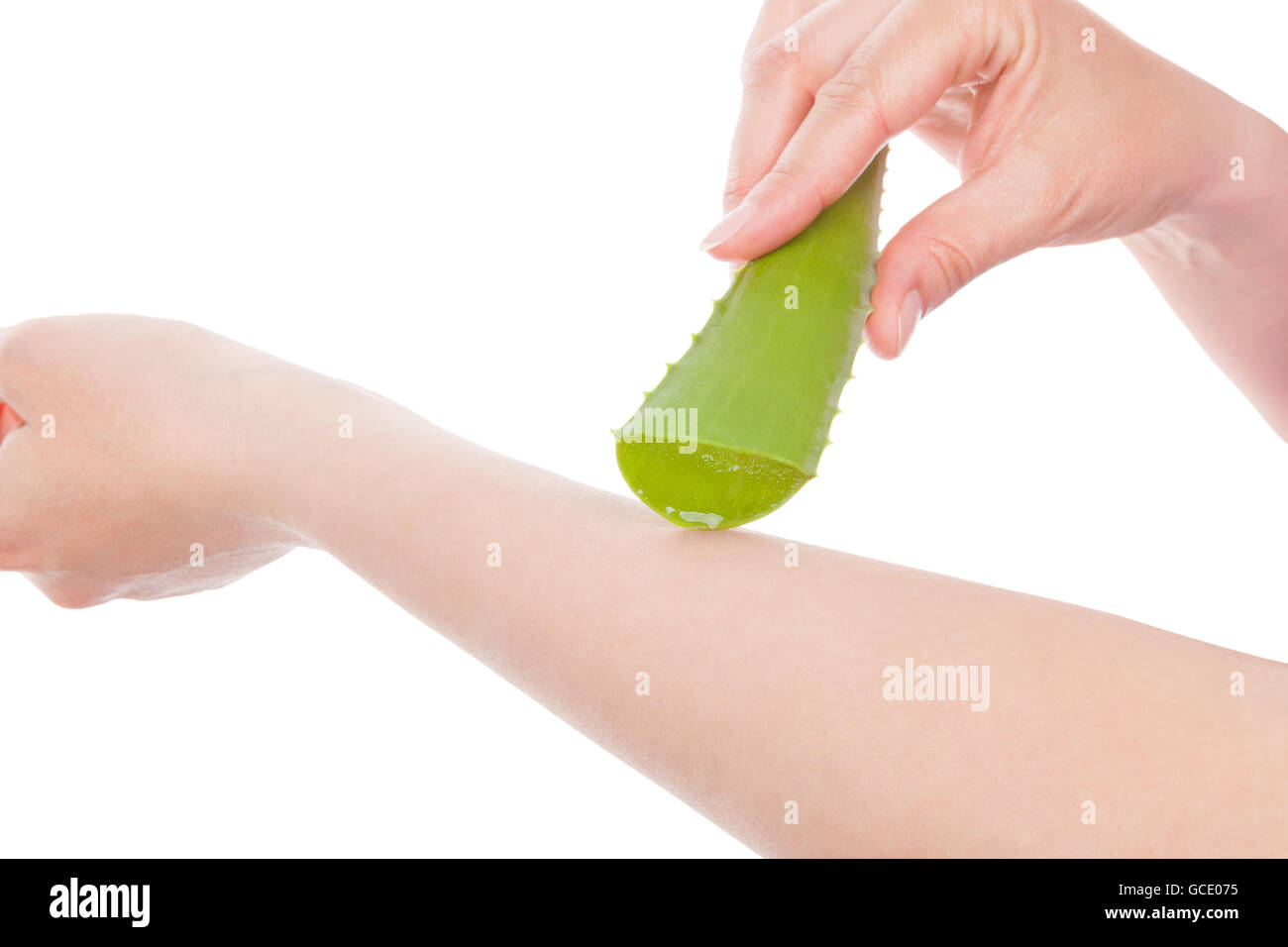 Female hand applying aloe vera gel on a skin burn. Natural alternative