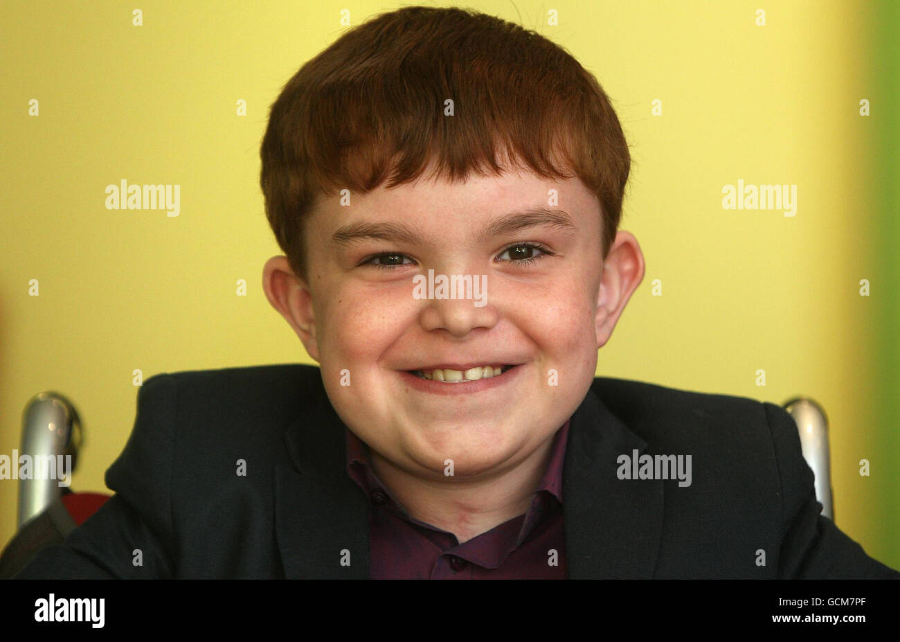 Ciaran FinnLynch, aged 11, who is the recipient of the world's first
