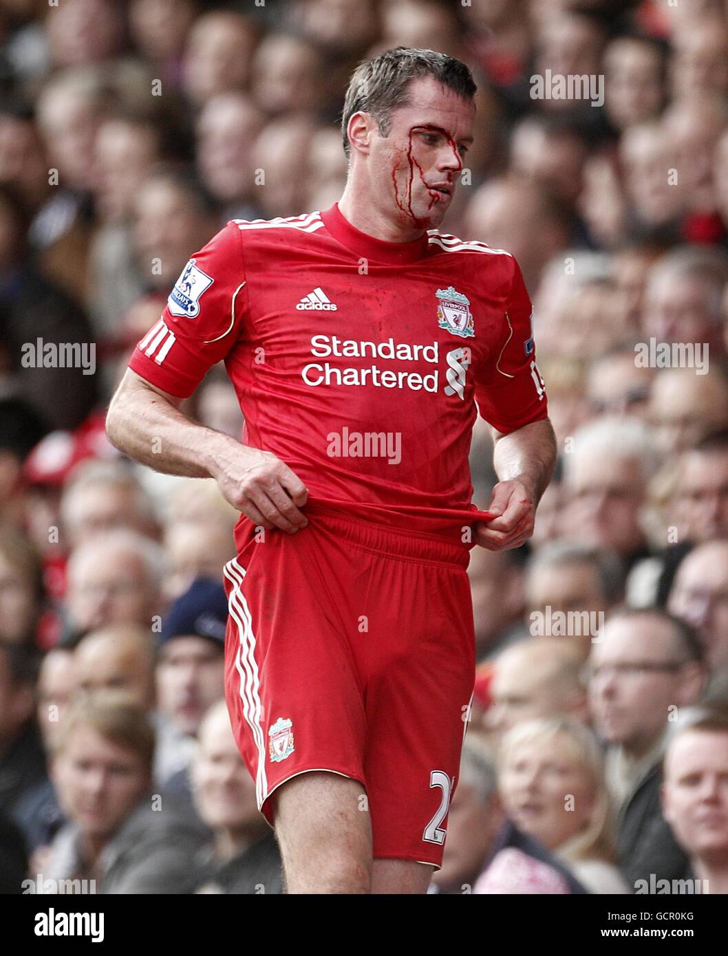 Liverpools jamie carragher cut on head collision teammate martin skrtel