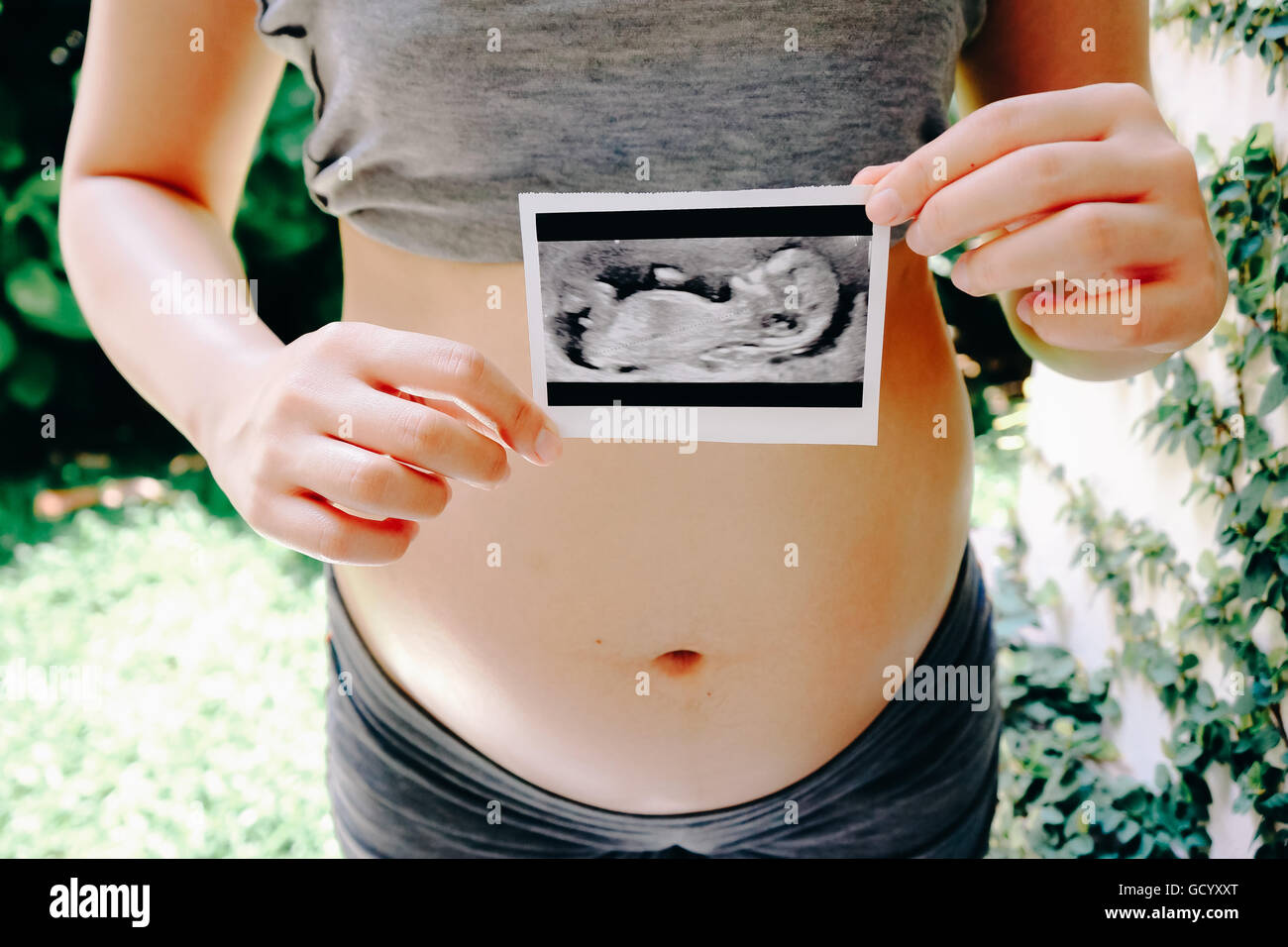 Ultrasound scan pregnant woman hi-res stock photography and images - Alamy