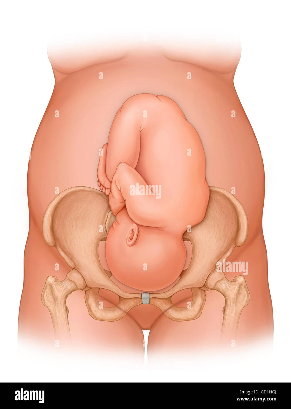 Front view of a woman nine months pregnant  (baby phantomed within) ready for delivery, with baby in proper position for delivery Stock Photo