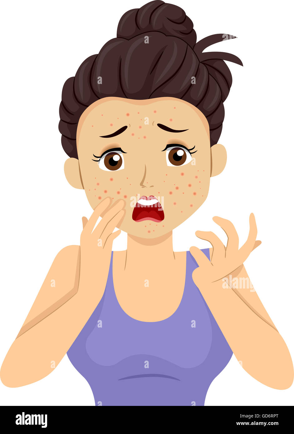 Pimple illustration hi-res stock photography and images - Alamy