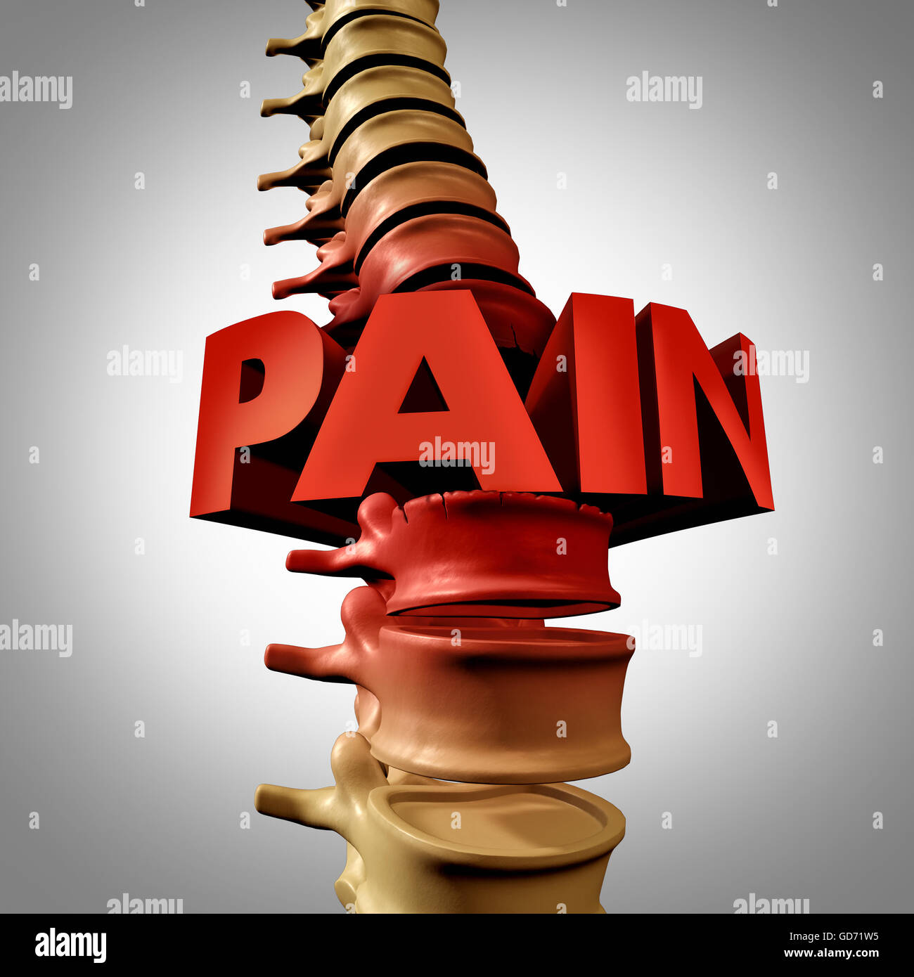 Human spine pain text and spinal fracture or traumatic vertebral injury medical concept as an anatomy spinal column with a painful vertebra due to compression and osteoporosis back disease as a 3D illustration. Stock Photo