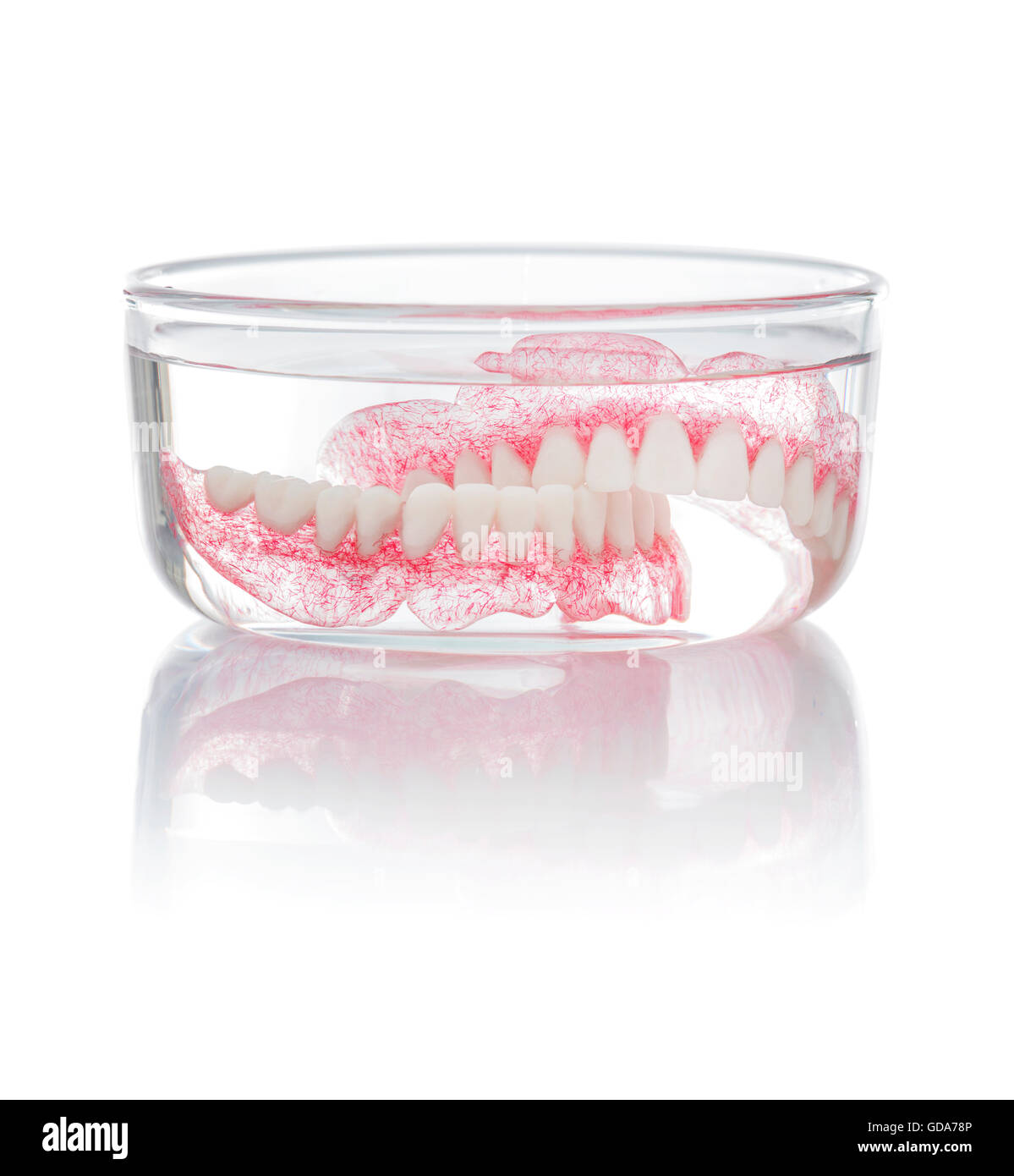 Как долго привыкать к съемным зубным. Как долго привыкать к съемным зубным. Челюсть в стакане. Частичный съёмный протез акрон. Как долго привыкать к съемным зубным.