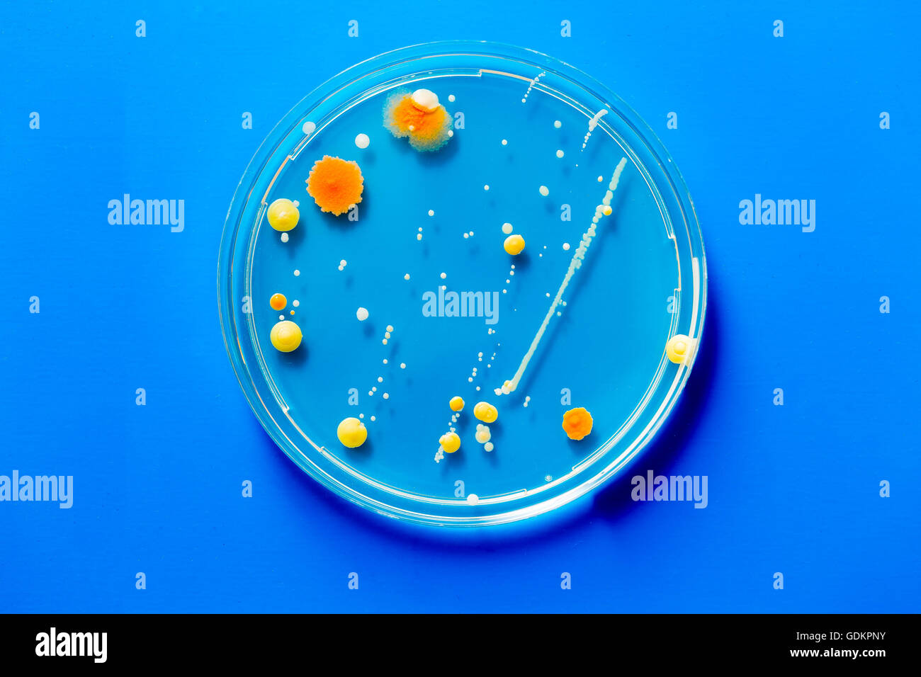 Petri dish with pathological microbe colonies Stock Photo