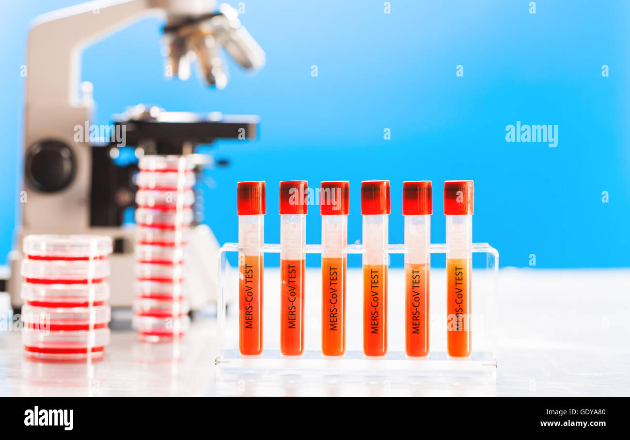 Blood test for the presence of Middle East respiratory syndrome coronavirus (MERS-CoV) Stock Photo