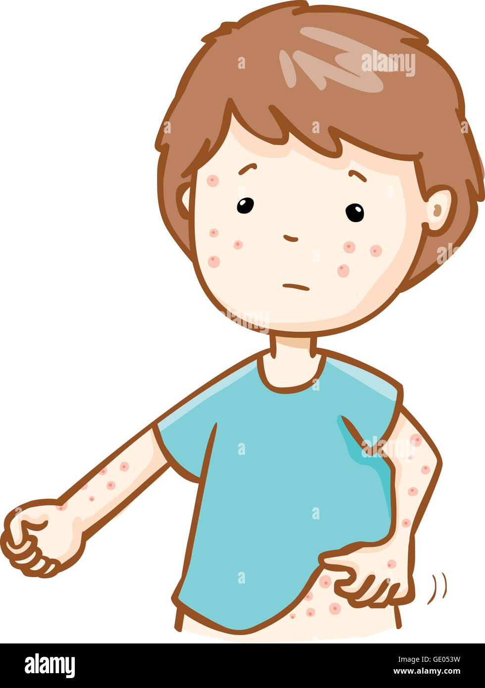 man with health problem allergy rash itching vector Stock Vector Art