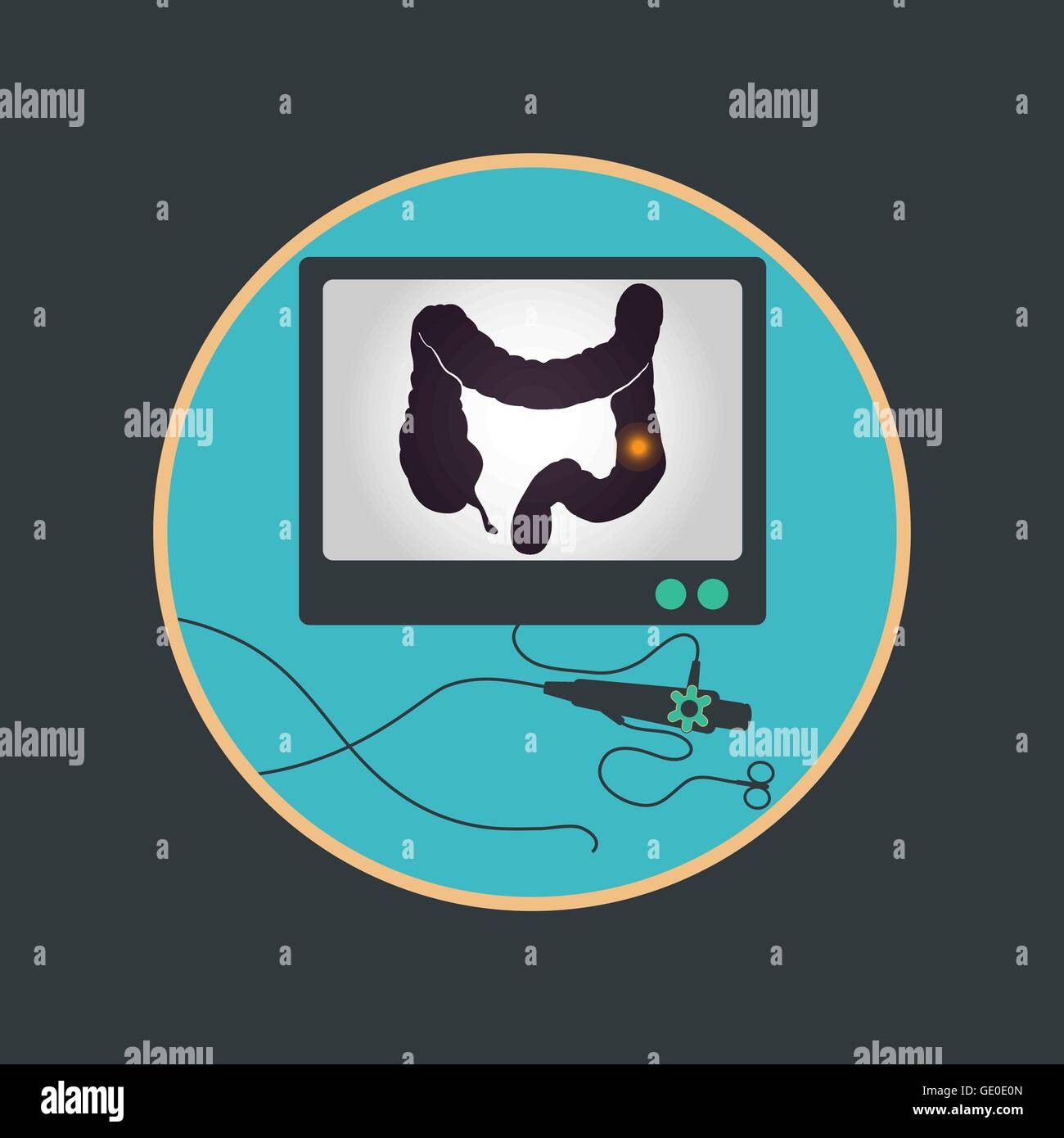 Screening For Bowel Cancer Stock Vector Images Alamy screening-for-bowel-cancer-stock-vector-images-alamy