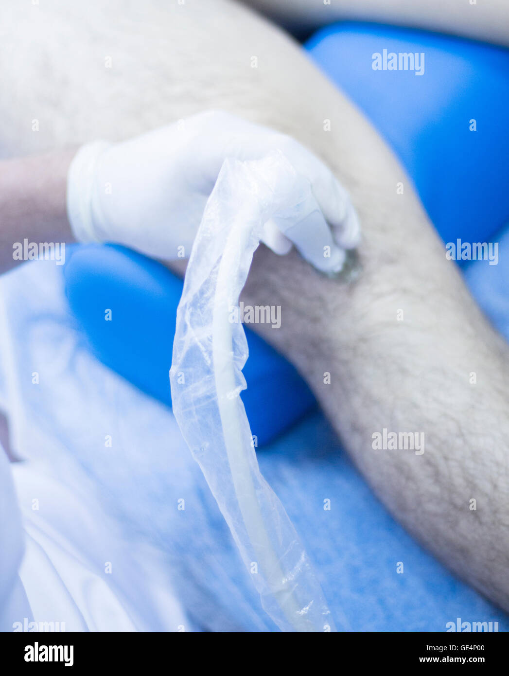Percutaneous electrolysis hi-res stock photography and images - Alamy