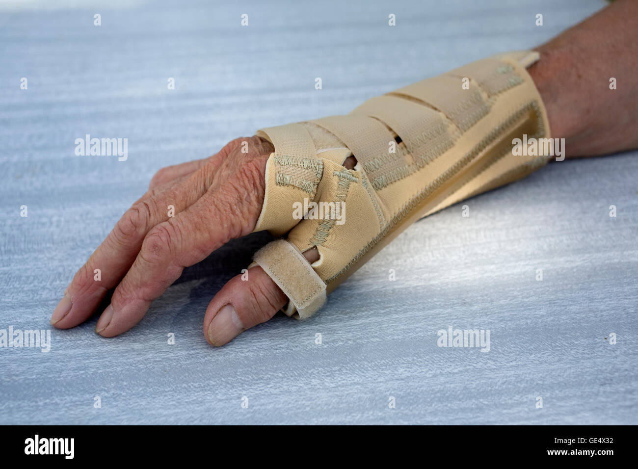 Arthritic hand supported by Ossur neoprene arthritis wrist thumb brace UK Stock Photo