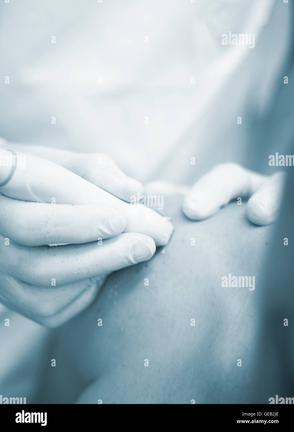 Percutaneous electrolysis hi-res stock photography and images - Alamy