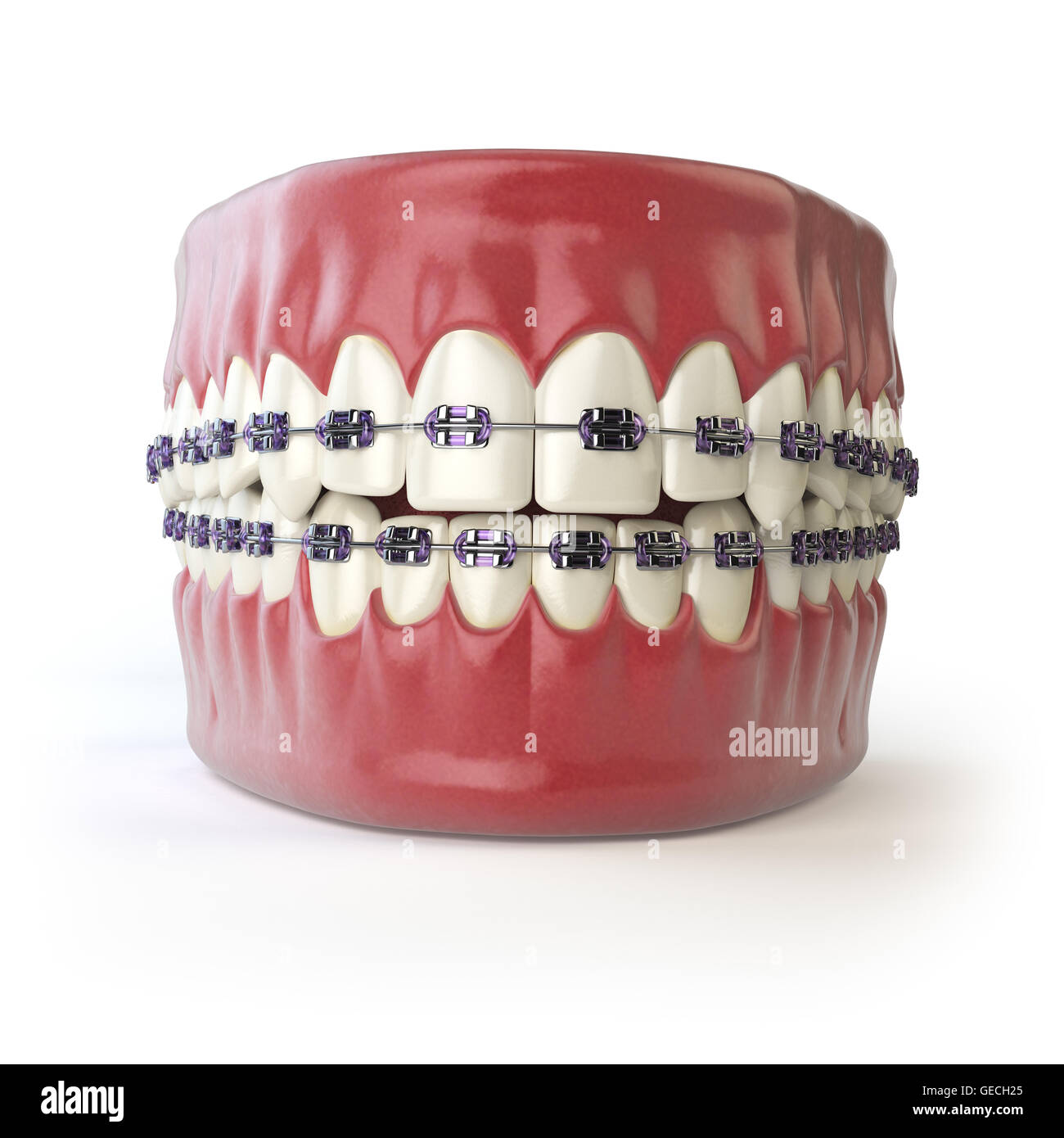 Teeth with braces or brackets isolated on white. Dental care concept. 3d illustration Stock Photo