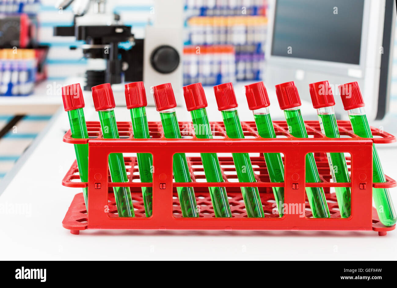 Green liquid in the test tubes in laboratory with microscope Stock ...