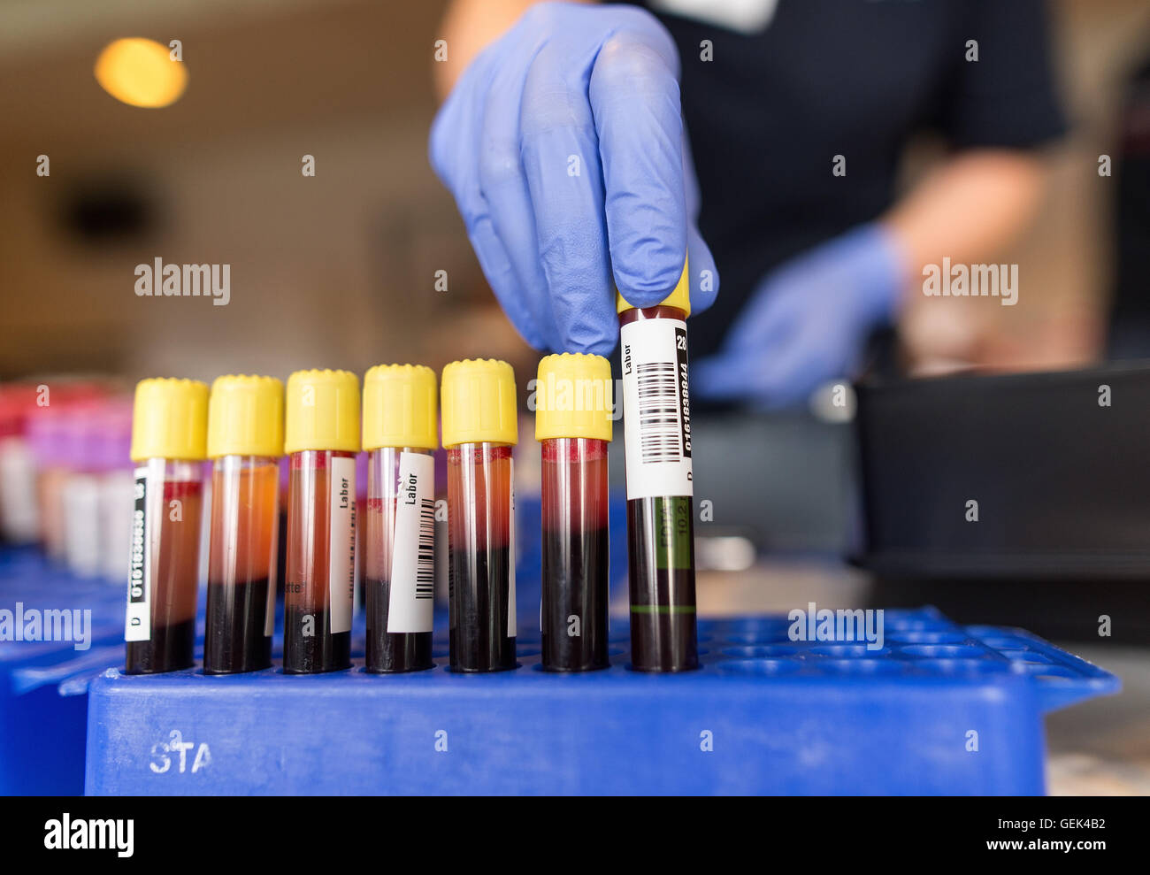 Lab Helpers Helper sorts blood donation container hi-res stock photography and ...