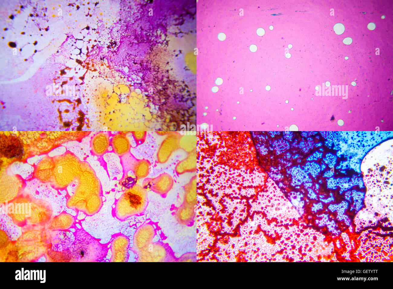 Set of science microscopic section of tissue. Real shots. Possibly out of focus area Stock Photo