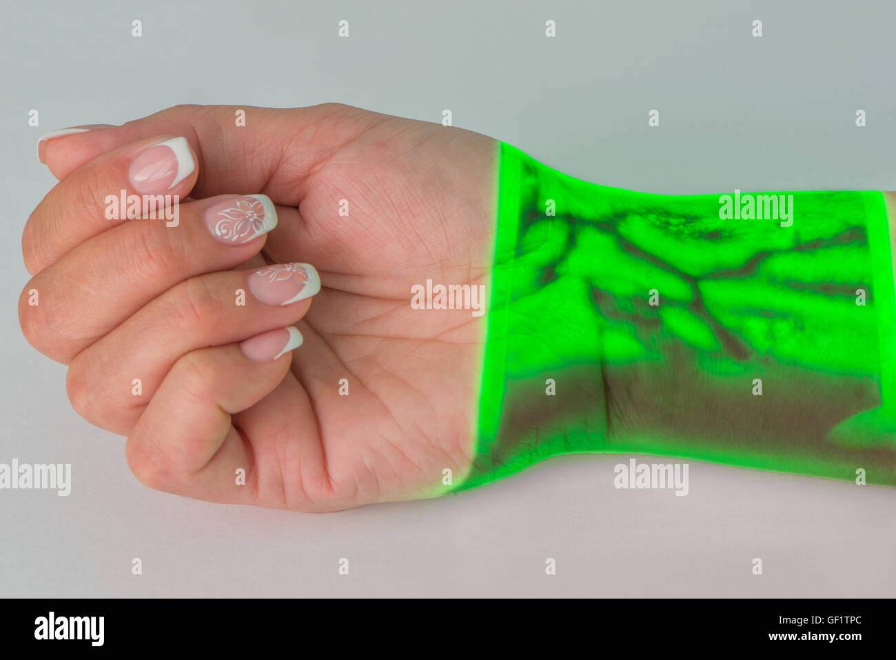 The venous drawing on a hand wrist received by means of Vein Viever Vision Stock Photo