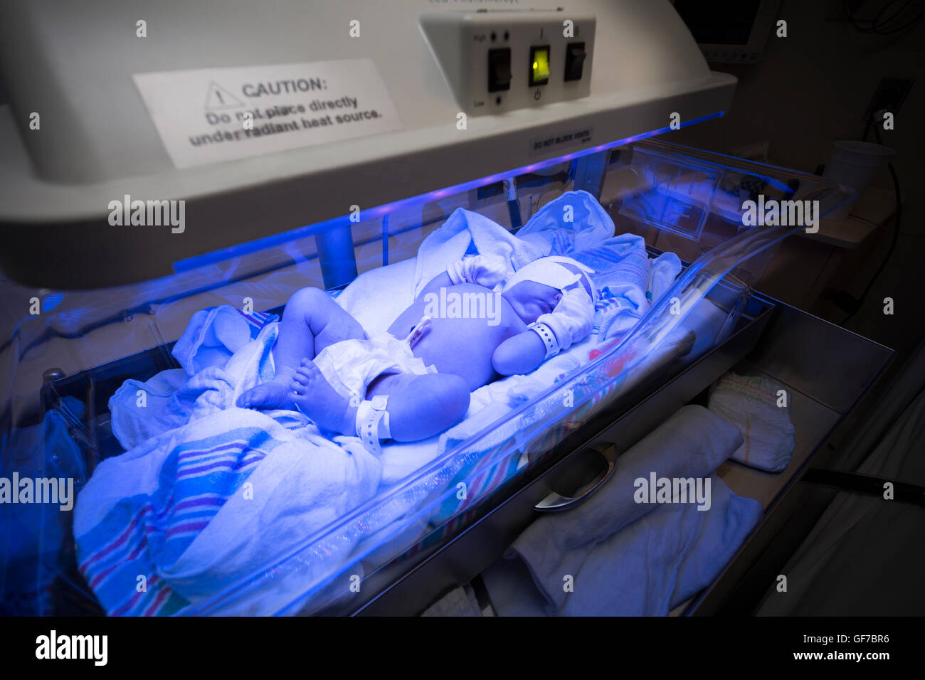 newborn infant receiving phototherapy for jaundice Stock Photo