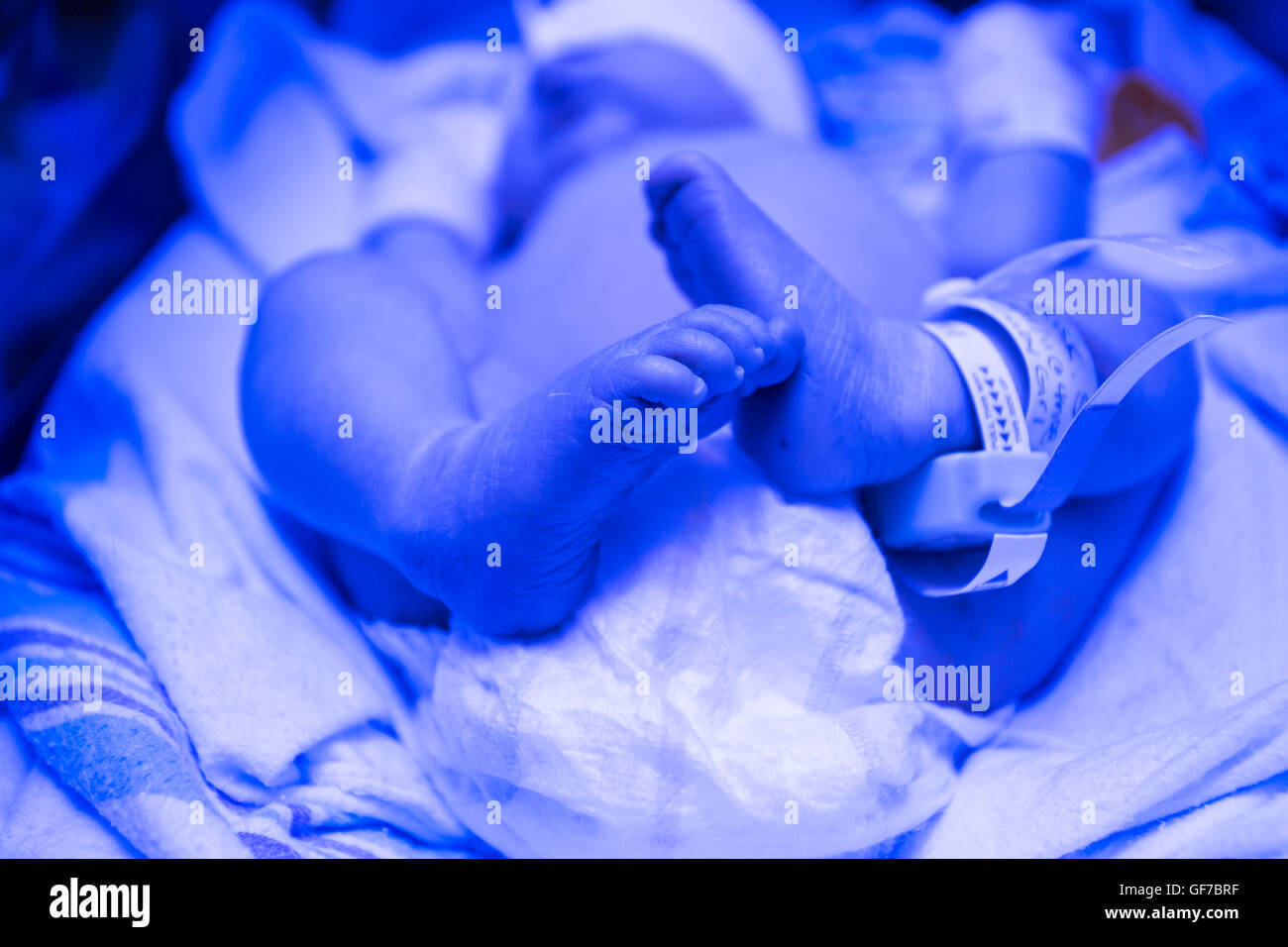 feet of newborn infant receiving phototherapy for jaundice Stock Photo