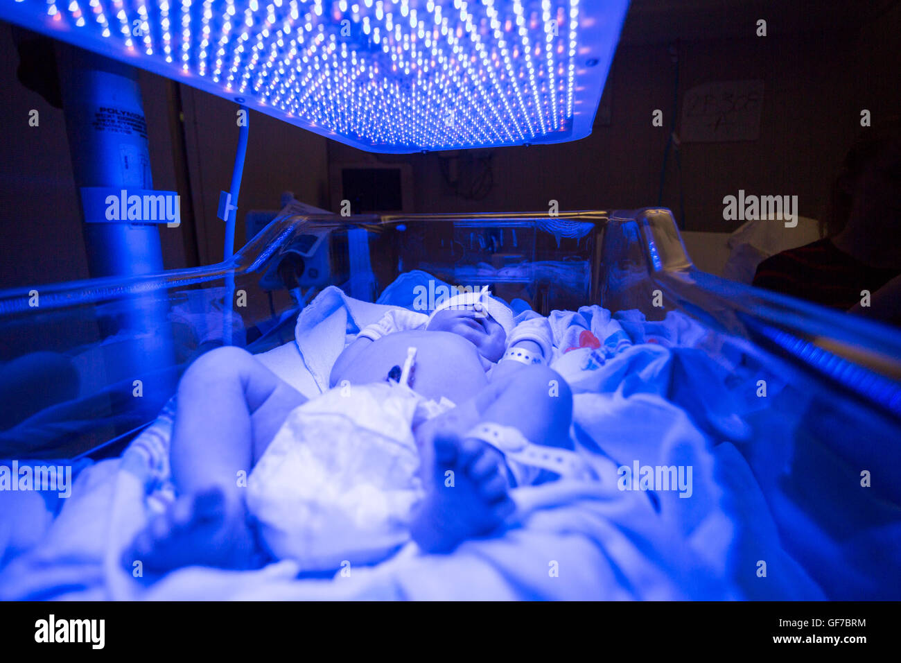 newborn infant receiving LED phototherapy for jaundice Stock Photo