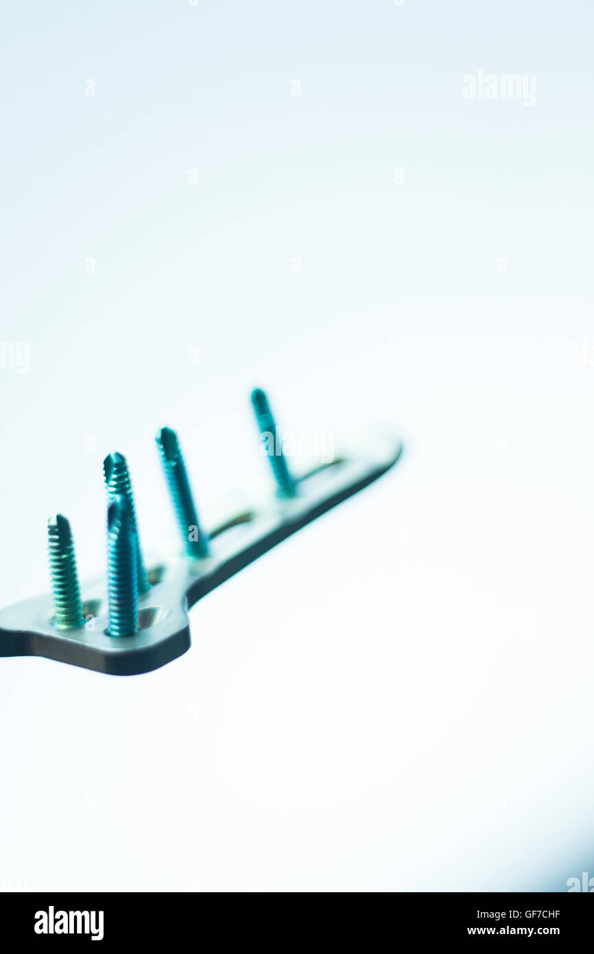 Orthopedics and Traumatology surgery plate & screws surgical titanium metal implant closeup