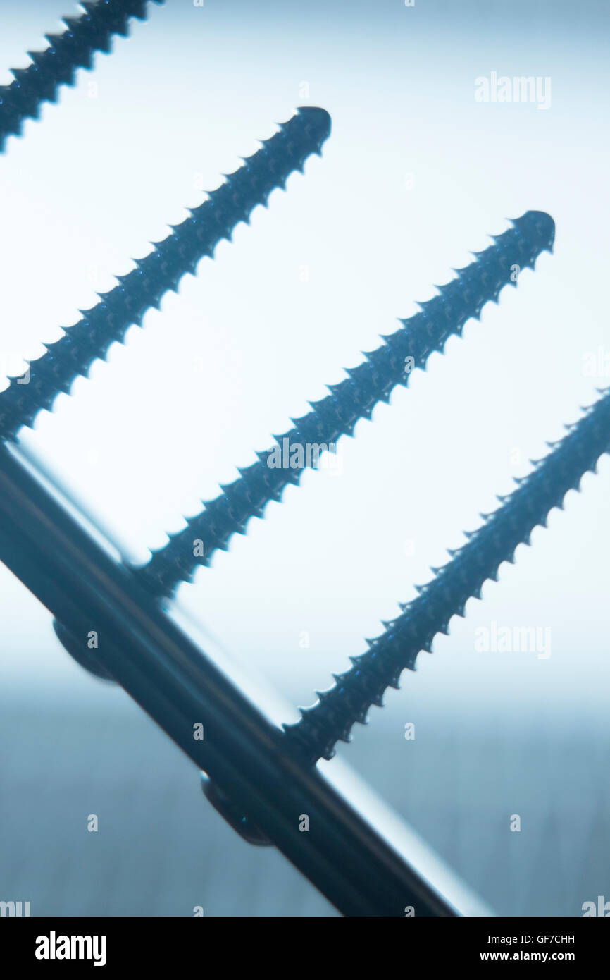 Orthopedics and Traumatology surgery plate & screws surgical titanium