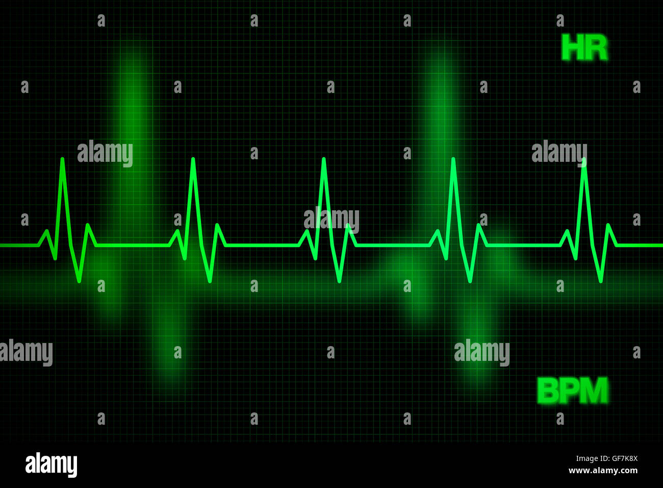 Doordeweekse dagen Bestrooi toevoegen Heart rate graph hi-res stock photography and images - Alamy