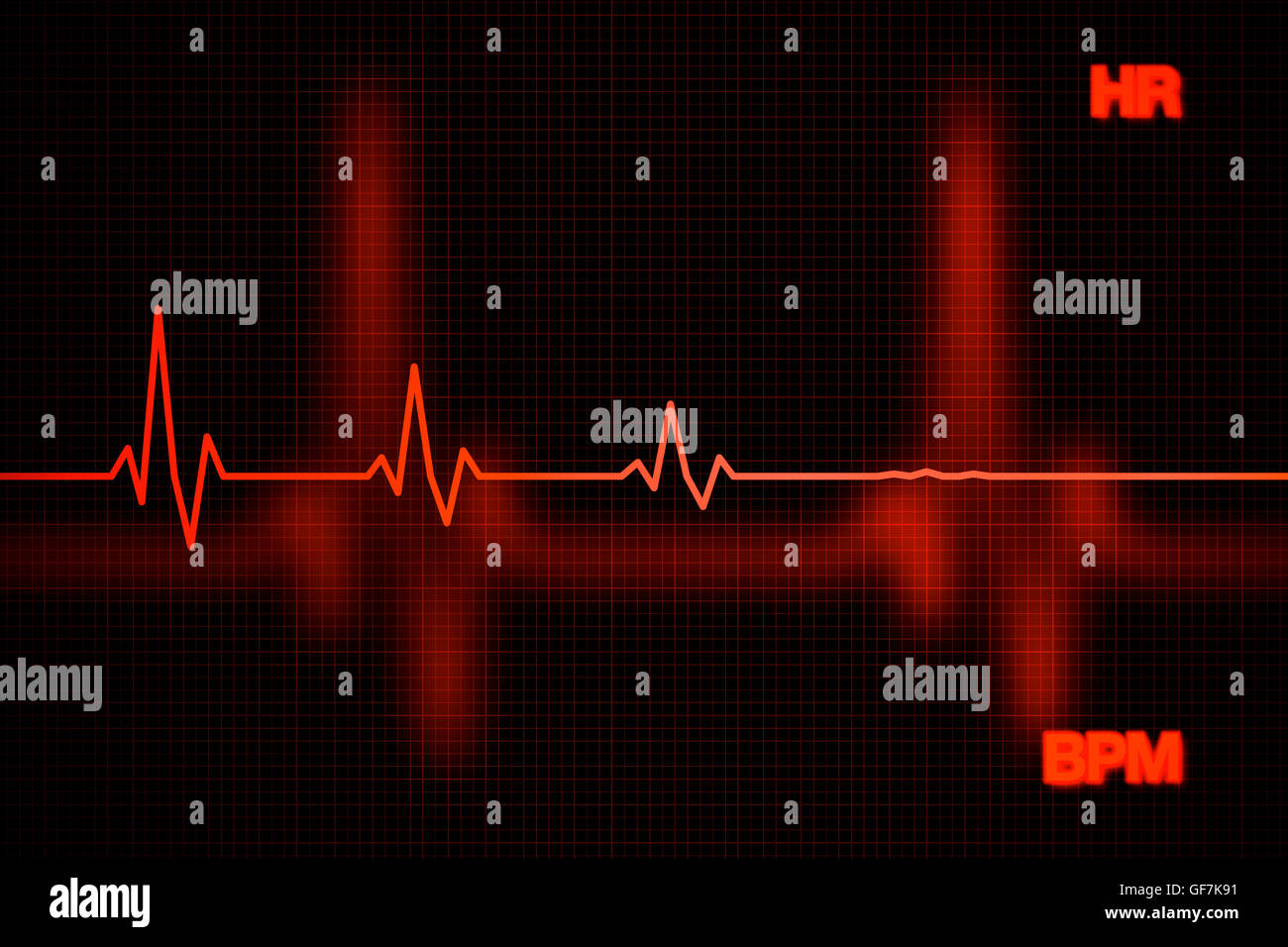 Heart rate monitor hi-res stock photography and images - Alamy