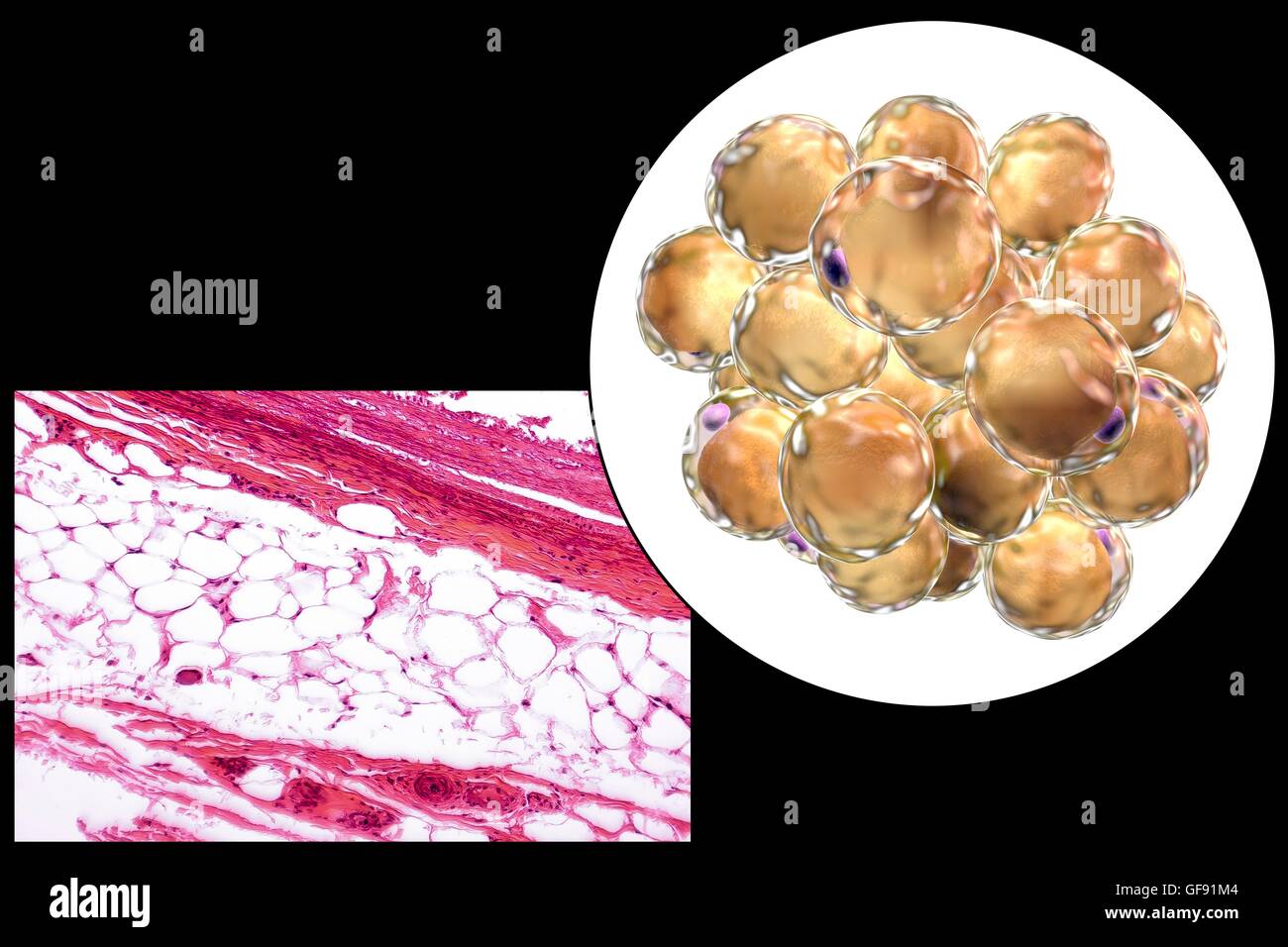 Fat cells, light micrograph and computer illustration. White adipose tissue composed of adipocytes (fat cells). Adipocytes form adipose tissue, which stores energy as an insulating layer of fat. White adipose tissue is used as a store of energy but also a Stock Photo