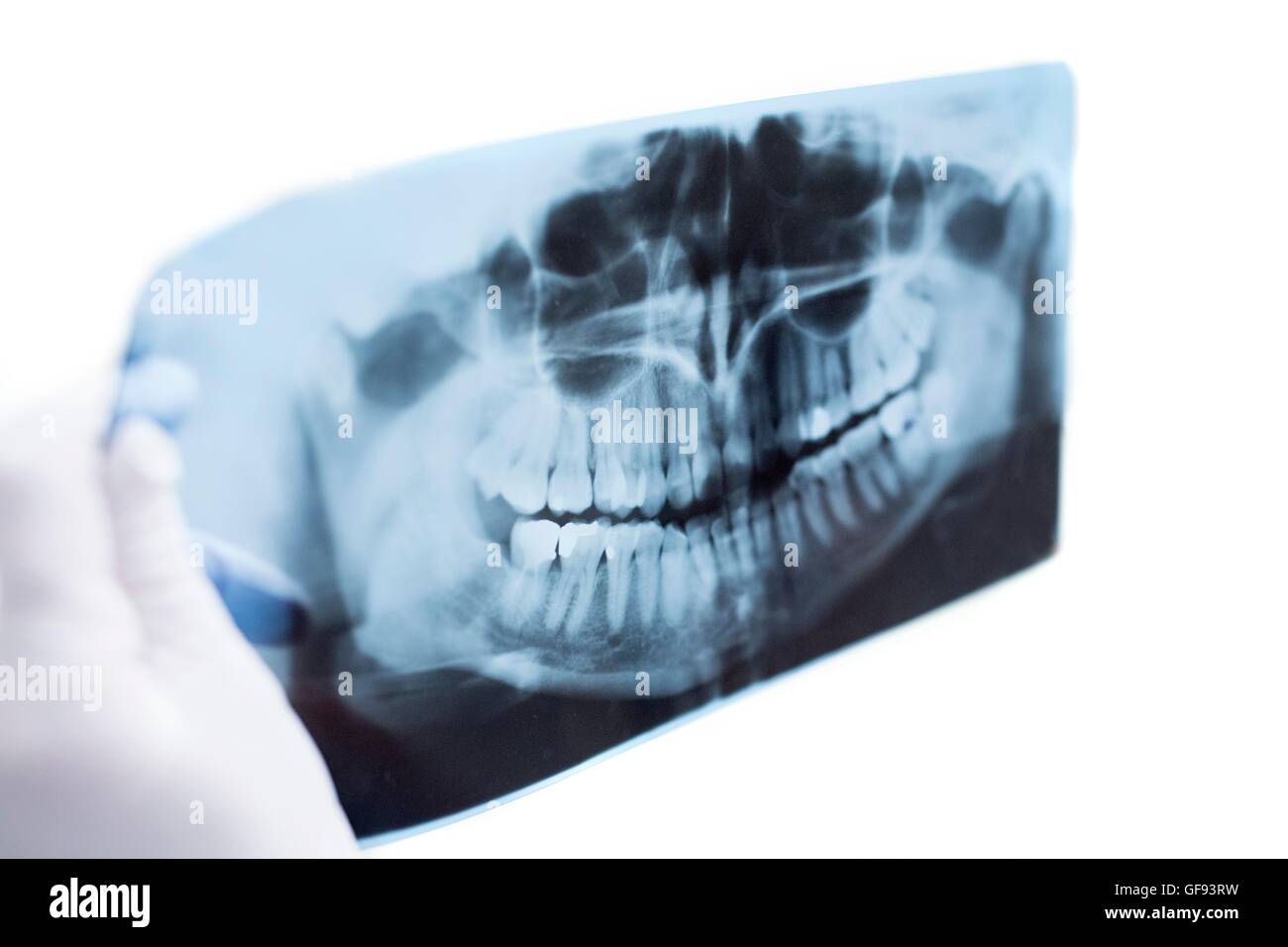 Dentist holding teeth model and medical x-ray in hospital. Stock Photo
