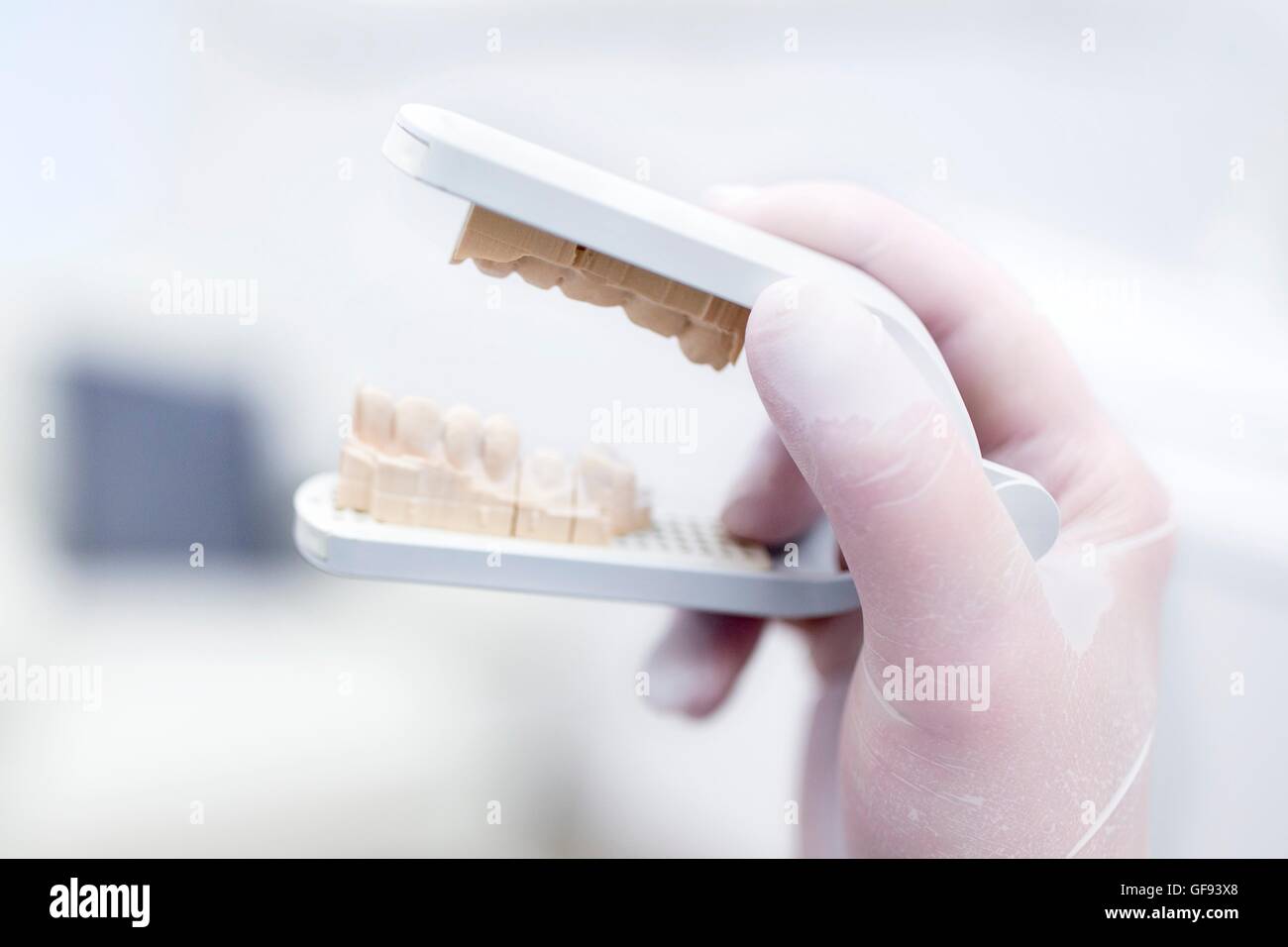 Dentist holding dental mould in dentist clinic. Stock Photo