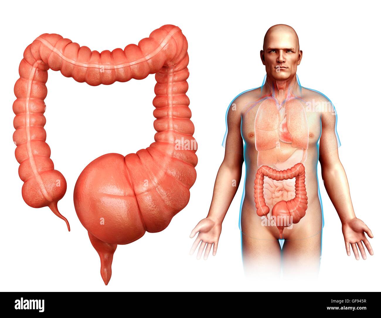 Illustration of mega colon Stock Photo - Alamy