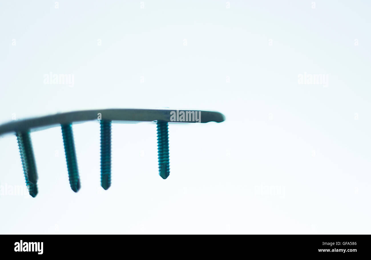 Orthopedics and Traumatology surgery plate & screws surgical titanium metal implant closeup