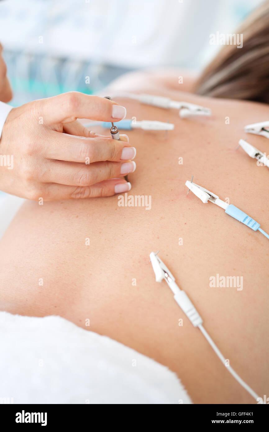 Doctor applying electroacupuncture on patient's back Stock Photo