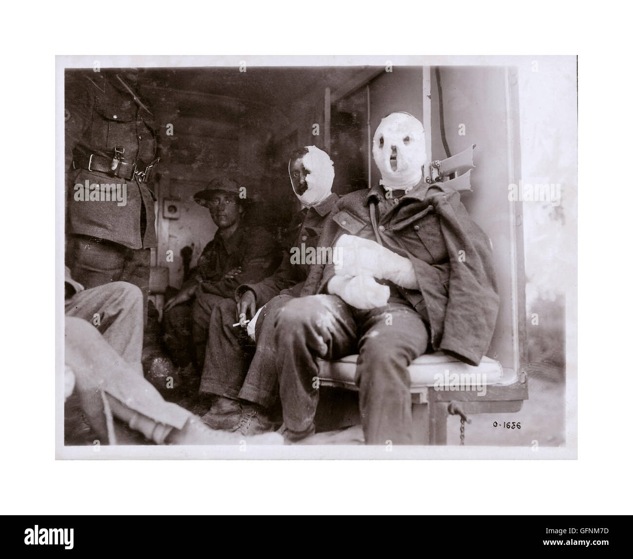 MUSTARD GAS 19141918 WWI extensive bandages on wounded Canadian Stock