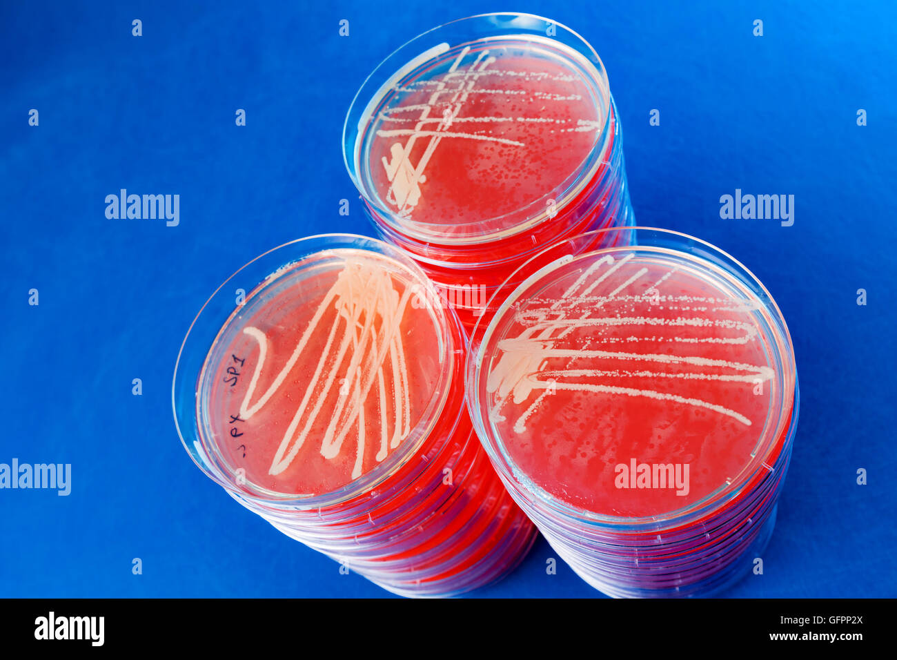 Petri dishes with bacterial colonies. Closeup Stock Photo Alamy