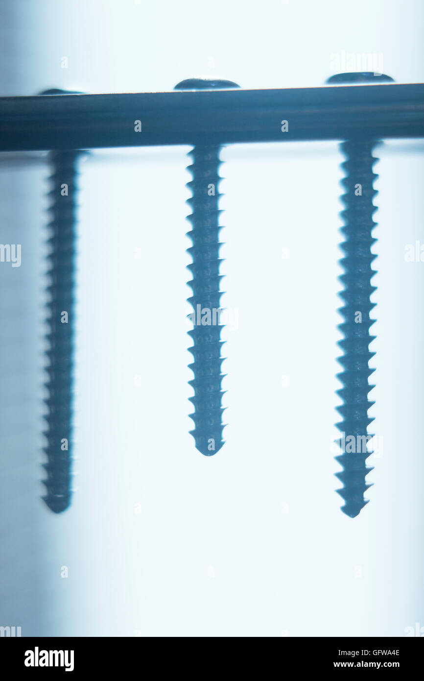 Orthopedics and Traumatology surgery plate & screws surgical titanium metal implant closeup