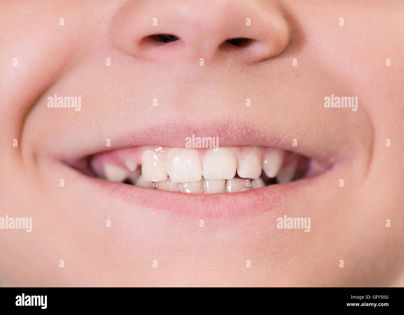 Mouth with white teeth Stock Photo Alamy